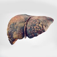 Fígado comprometido